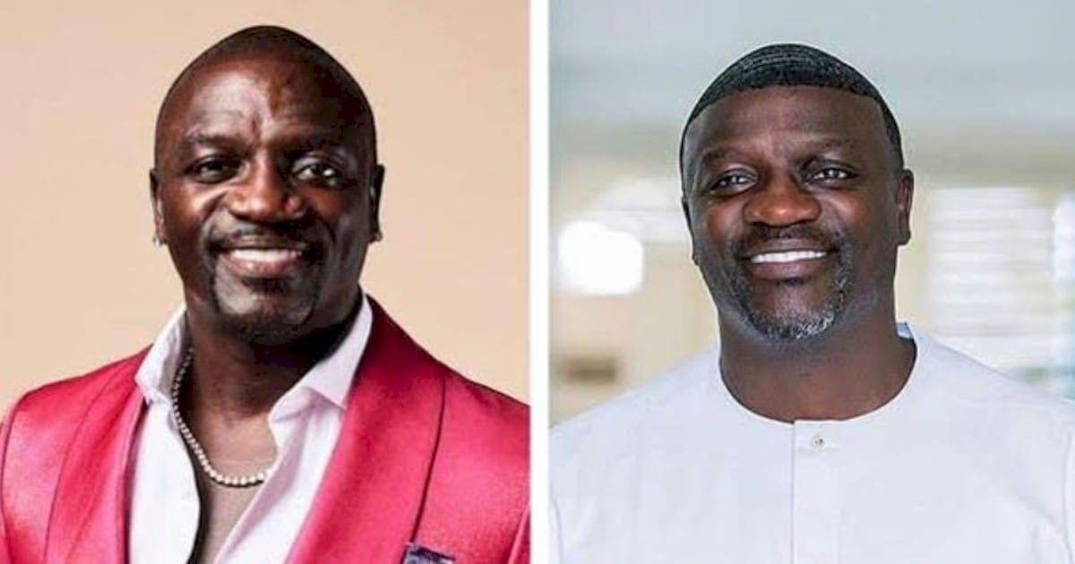O que aconteceu com a aparência do cantor Akon, diz Dr. Carlos Filho